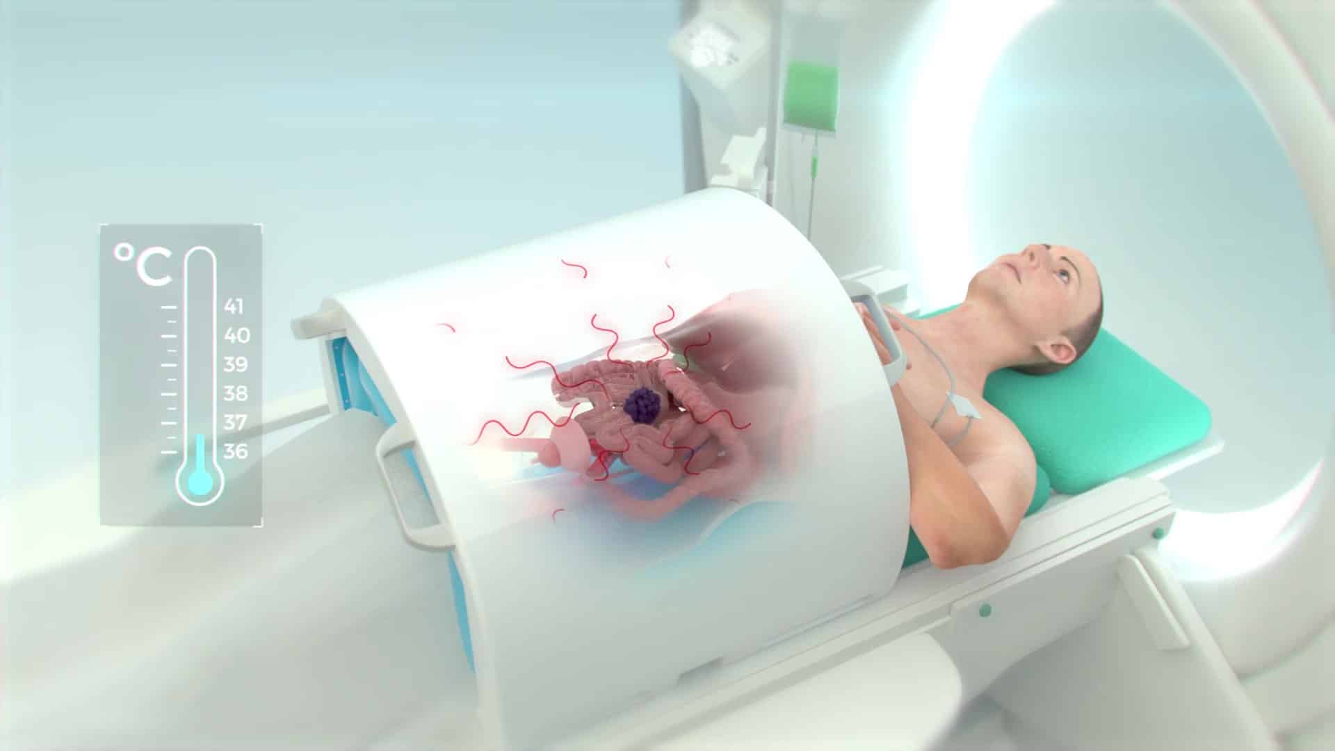 3d Medical Animation Video